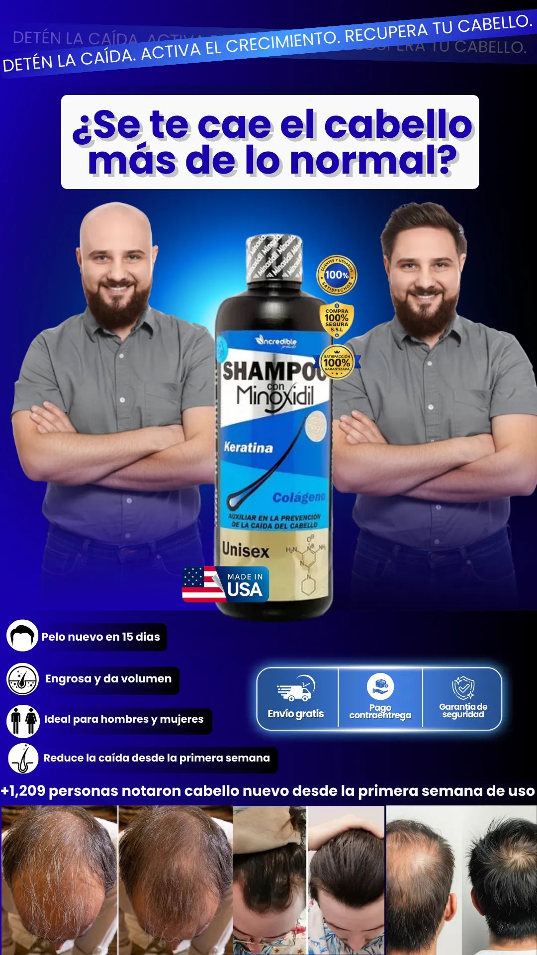 Minoxidil Shampoo| Freno total a la calvicie y caída severa