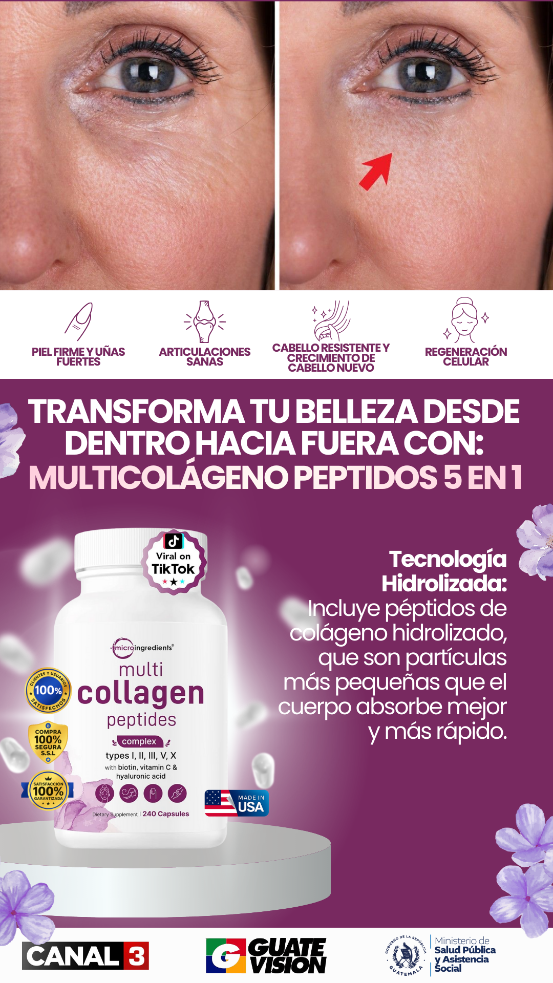 Multicolágeno 5 en 1 | Detén la caída del cabello y repara tus uñas.